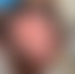 có nên tẩy tóc tại nhà không, những hậu quả khi tự tẩy tóc tại nhà, hiểm hoa khi tẩy tóc tại nhà