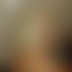 có nên tẩy tóc tại nhà không, những hậu quả khi tự tẩy tóc tại nhà, hiểm hoa khi tẩy tóc tại nhà