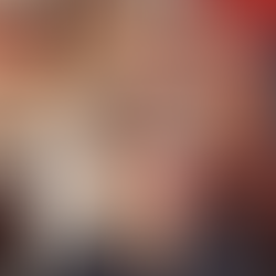 có nên tẩy tóc tại nhà không, những hậu quả khi tự tẩy tóc tại nhà, hiểm hoa khi tẩy tóc tại nhà