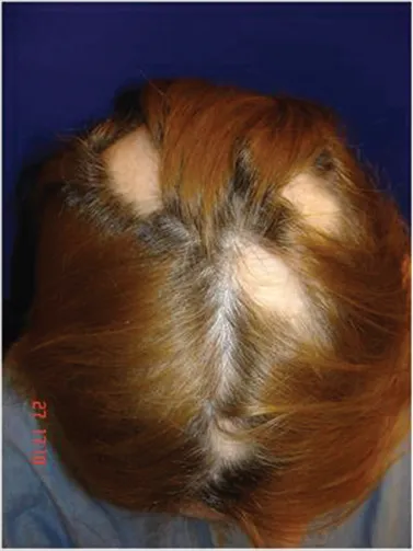 có nên tẩy tóc tại nhà không, những hậu quả khi tự tẩy tóc tại nhà, hiểm hoa khi tẩy tóc tại nhà