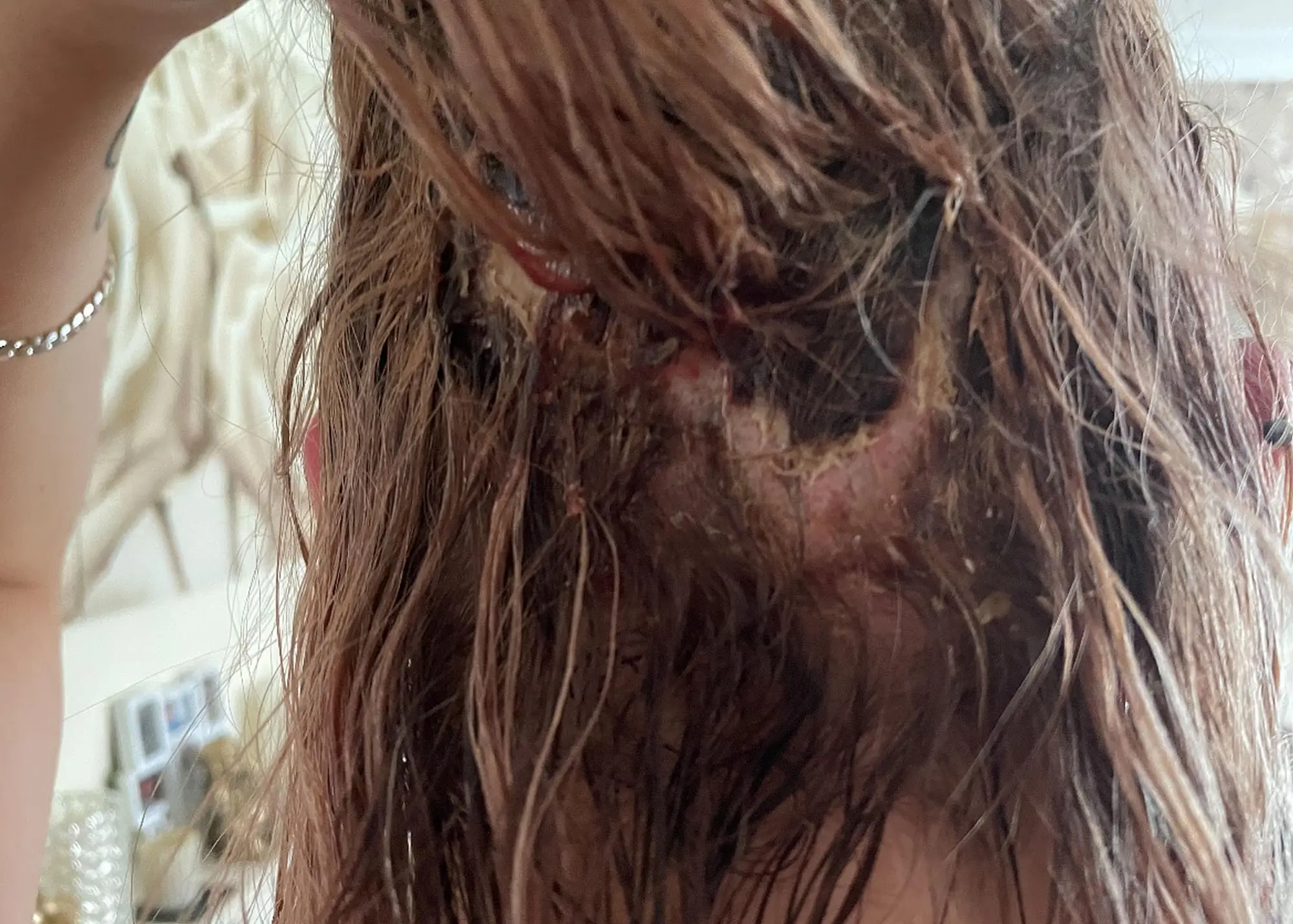 có nên tẩy tóc tại nhà không, những hậu quả khi tự tẩy tóc tại nhà, hiểm hoa khi tẩy tóc tại nhà