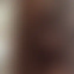 có nên tẩy tóc tại nhà không, những hậu quả khi tự tẩy tóc tại nhà, hiểm hoa khi tẩy tóc tại nhà
