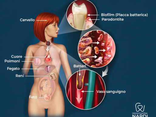 Malattie gengivali e salute generale