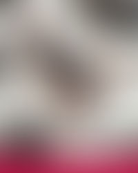 Acidentes com animais peçonhentos aumentam nessa época do ano. 