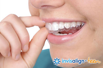 orthodontie_ado_2.jpg