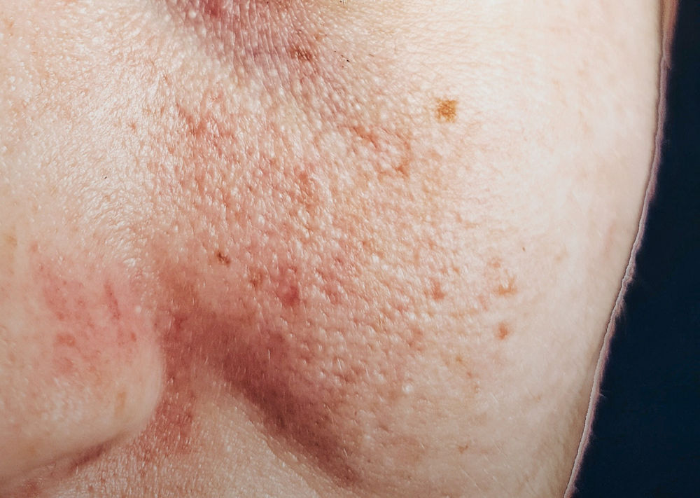 alcohols-in-skincare