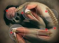 Massage and Arthritis