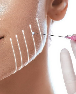 April-Blog-PDO-Thread-Lift-Thread-Smooth-Botox-Fillers-1080x675.jpeg
