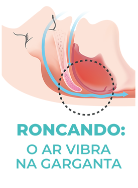 roncoando.png