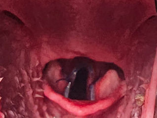Non-surgical options for canine laryngeal paralysis