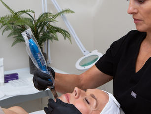 The Power of Personalised Skincare: Tailoring Treatments to Your Unique Skin Needs