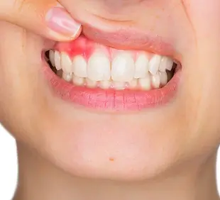 periodontoloji.webp