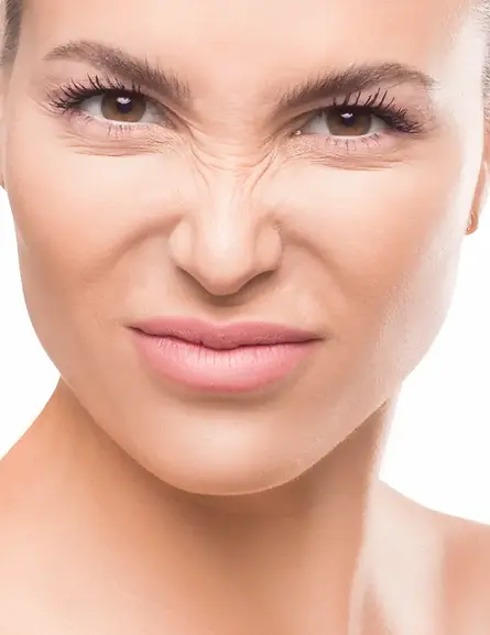 Anti-wrinkle injections Marylebone London — natural results at Skin Lab Medispa Baker Street