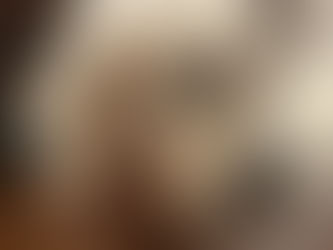 Usunięcie ślinianki podżuchwowej