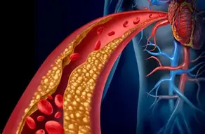 ❤️ Colesterol alto: como reduzir com alimentação e atenção aos sinais silenciosos