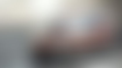 Monte Mario, incidente tra auto e monopattino