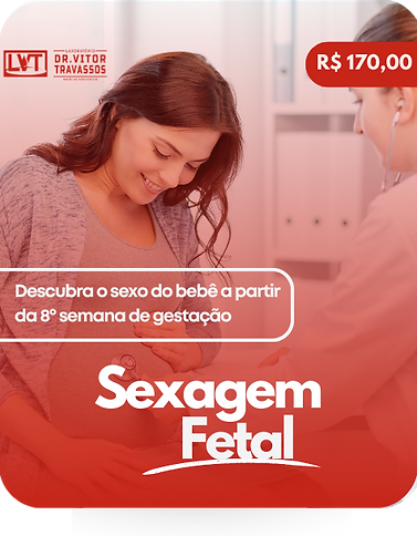 170 reais.png