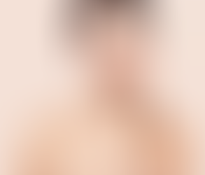 Illuminate Your Skin: Trends in Dubai's Whitening Treatments