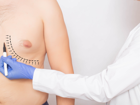 Key Benefits of Gynecomastia Surgery in Dubai
