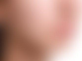 Achieve Clear Skin: Innovative Acne Treatments in Dubai