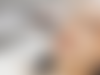 Achieve Natural Glow Today with Proven Hydrafacial Price Strategies