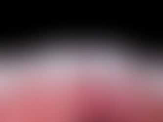 Dental Veneers: Transform Your Smile