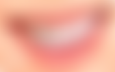 Teeth Whitening in Dubai: What You Need to Know