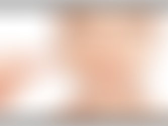 Reveal Your Skin’s True Beauty Using Melasma Treatment