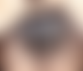Regain Your Confidence: Dubai's Best Hair Restoration Options