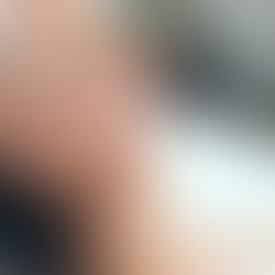 Unlock Your Glow Potential with Mesotherapy Cost Tips