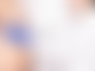 Gynecomastia Surgery: The Recovery Journey