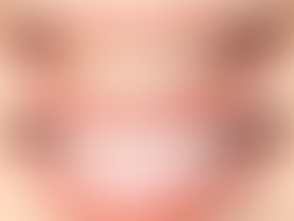 Enhance Your Smile with Veneers Dubai Guide