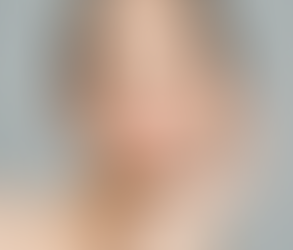 Glow Naturally With Skin Whitening Treatment Power