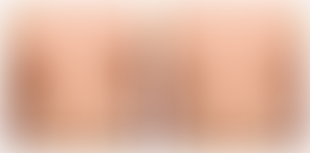 Exploring Gynecomastia Surgery in Dubai: A Guide
