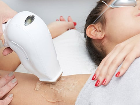 Religious Insight Into Laser Hair Removal and Islam