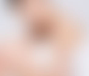 Is Laser Hair Removal Allowed in Islam?