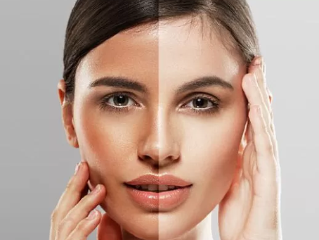 Brighten Your Complexion: Skin Whitening in Dubai