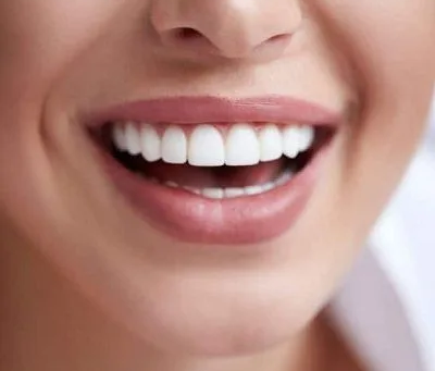 How Long Does Whitening Take in Treatments?