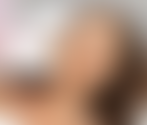 Experience Skin Perfection with Soft Light Laser Dubai Technology