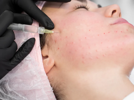 Laser Liposuction Transforming Your Body Into A Sleek Work Of Art