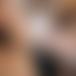 Achieve Hair-Free Perfection with Laser Hair Removal Magic