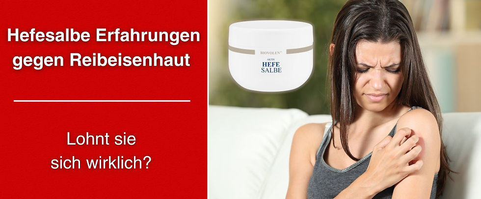 Hefesalbe Erfahrungen