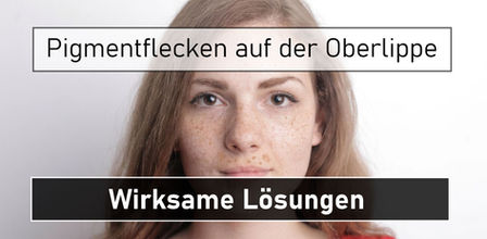 Pigmentflecken auf der Oberlippe