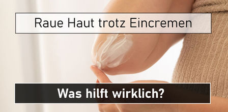 raue Haut trotz Eincremen