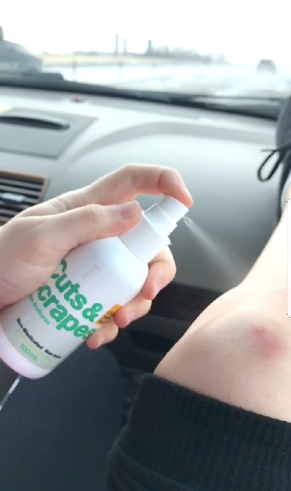 100ml Cuts & Scrapes