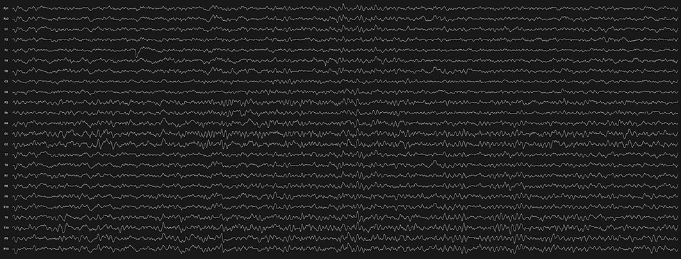 EEG lines (2).png