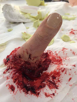 Severed Thumb