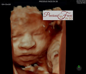 GA 31w2d - 3er trimestre_editado.jpg