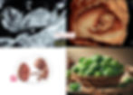Quad image illustrating the 11th week of pregnancy: A 2D ultrasound measuring the baby's length (top-left), a detailed 3D ultrasound clearly showing the developing fetus (top-right), a fetal illustration showing detailed Flo fetal development (bottom-left), and a bowl of Brussels sprouts representing the approximate size of the baby at this stage (bottom-right).