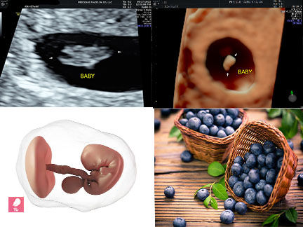 Your Pregnancy Journey in 3D Ultrasound: What’s Happening at 7 Weeks?